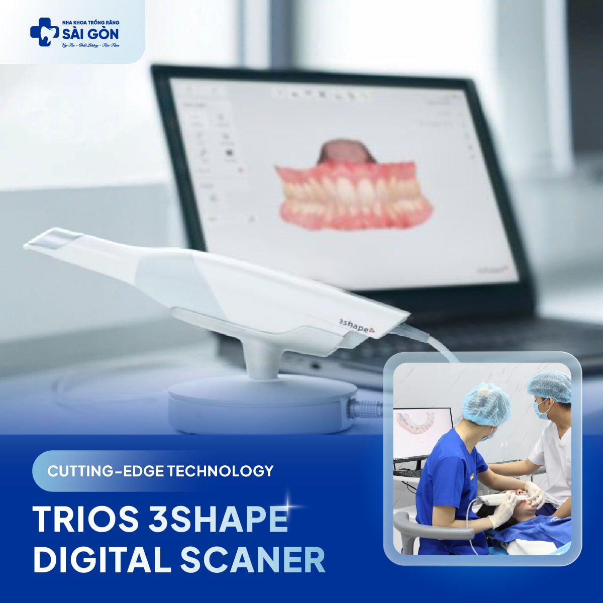 TRIOS 3Shape Digital Scan