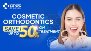 Cosmetic Orthodontics Save Up to 50% on Treatment