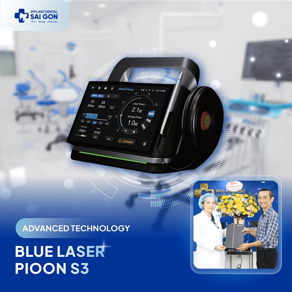 Advanced technology Blue Laser Pioon S3