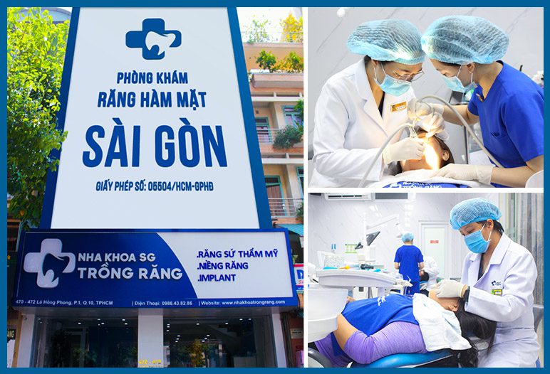 nha khoa trong rang sg 1 nha khoa trồng răng sài gòn